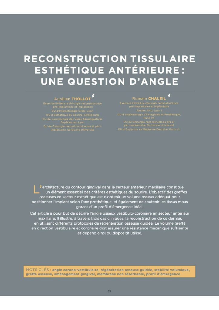 Reconstruction tissulaire esthétique antérieure : une question d'angle (Quintessence International)