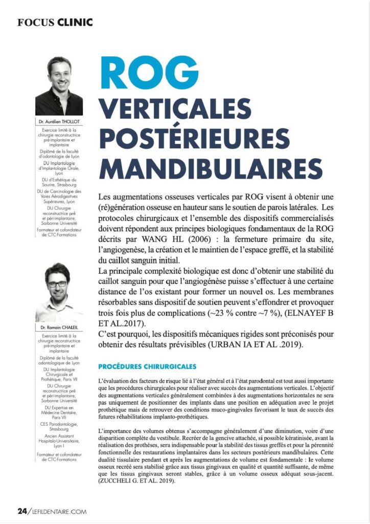 ROG verticales postérieures mandibulaires (Le Fil Dentaire 2022)